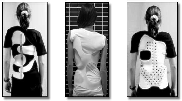 scoliosis brace designs