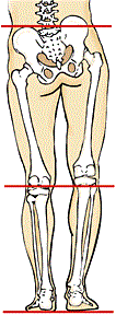 leg length and scoliosis