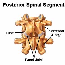 scoliosis in elderly