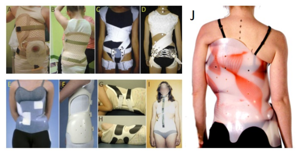 scoliosis brace - various styles