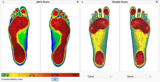 scoliosis orthotics