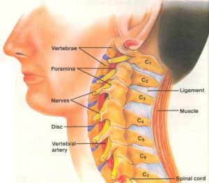 neck pain scoliosis