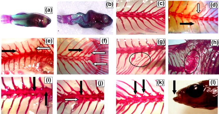 Examples of skeletal anomalies in A. fasciatus. (a): Normal specimen, (b): deformed specimen, (c): normal vertebral column profile, (d): the black arrow points to absence of spine, the white arrow points to fused spines. (e): The black arrow points to bifurcated spine, the white arrow points to broken spine. (f): The black arrow points to short spine, the white arrows point to detachment of spines. (g): Abnormal shape of three consecutive spines, (h): fused vertebrae, (i): hypertrophied vertebrae, (j): the black arrow points to atrophied vertebrae, the white arrows point to a Hypertrophied arcs, (k): detached arcs and (l): prognathe.