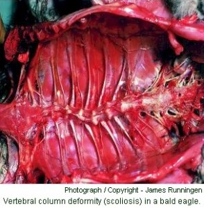 bald eagle scoliosis