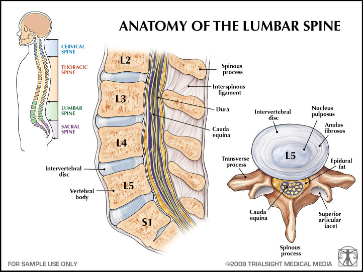 adult scoliosis surgery complications L5-S1