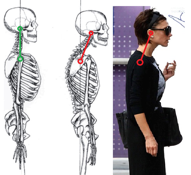 forward head posture in heels