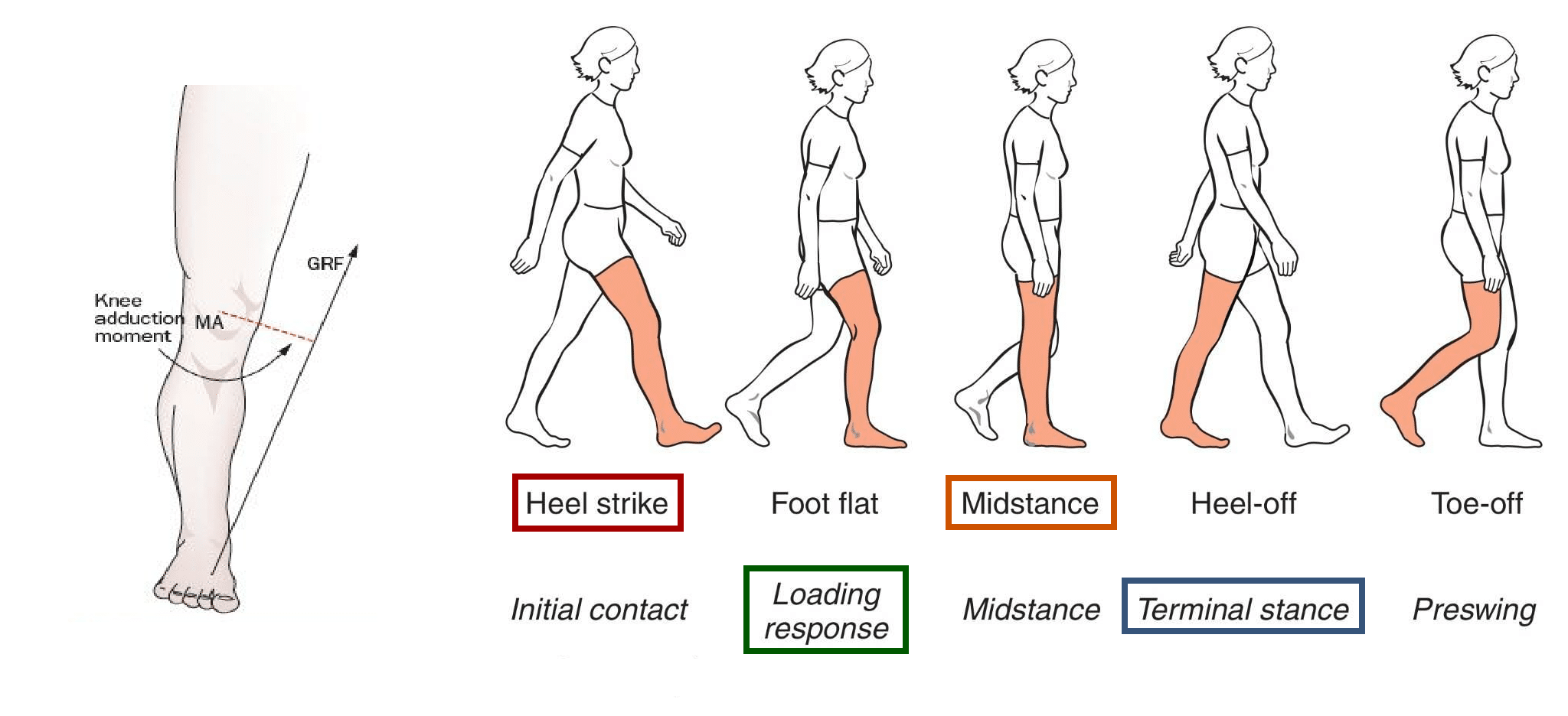 High Heels And Scoliosis Effects And Prevention