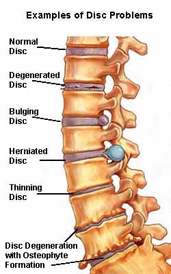 Examples of disc problems