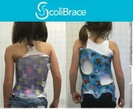 scoliosis treatment for child - brace