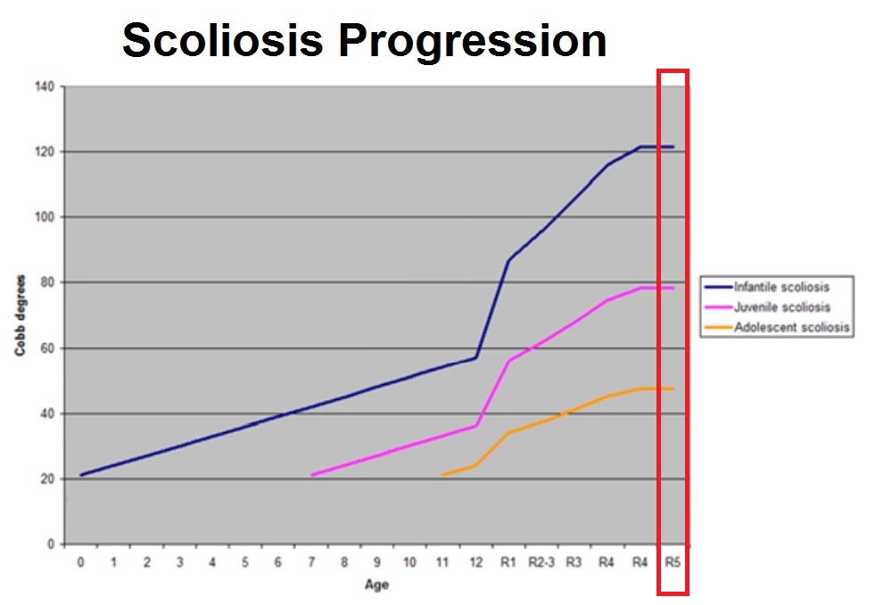 scoliosis progression risk chart
