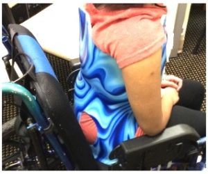 scoliosis brace for wheelchair