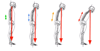 trigger points