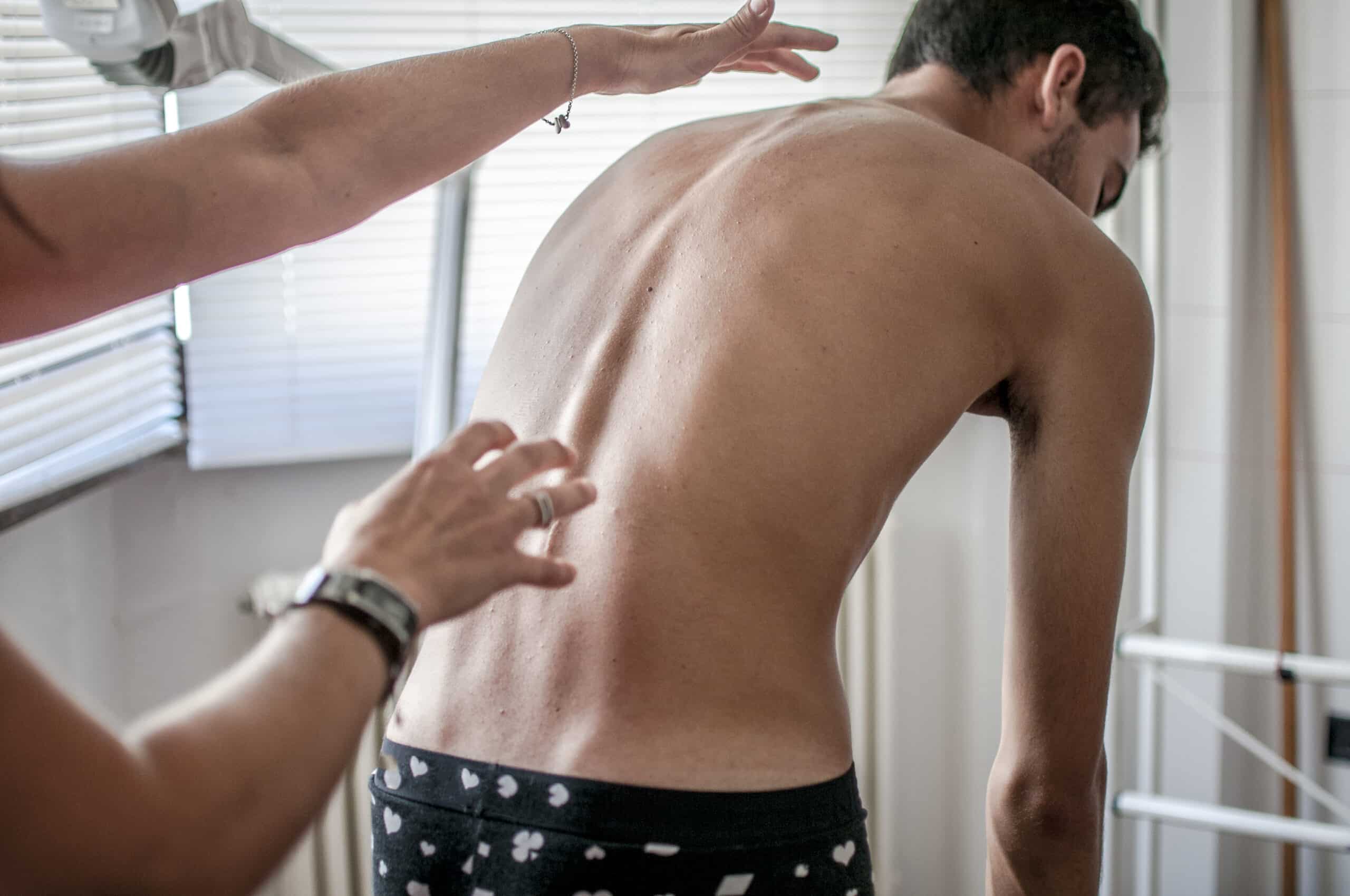 Scoliosis and Pinched Nerves